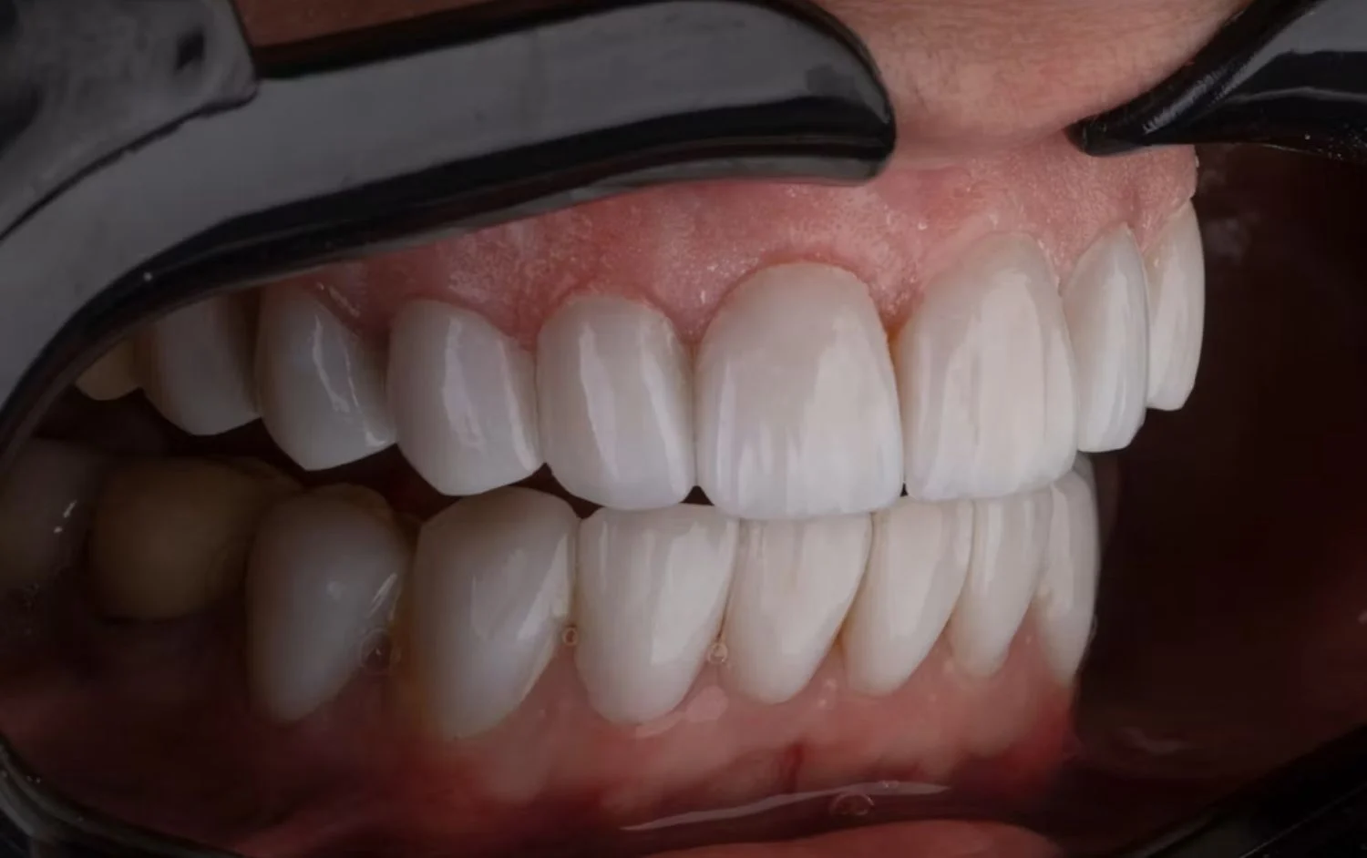 List of Top 15 Government Dental Colleges FI